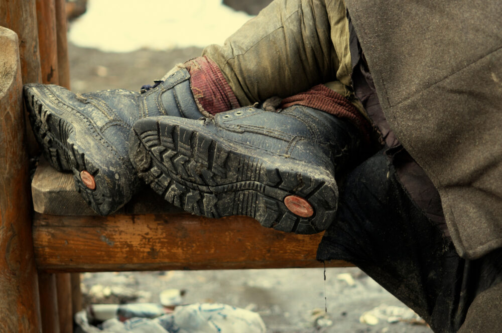 hobo legs